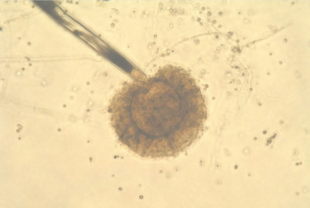 nấm ăn rác Aspergillus tubingensis.jpg