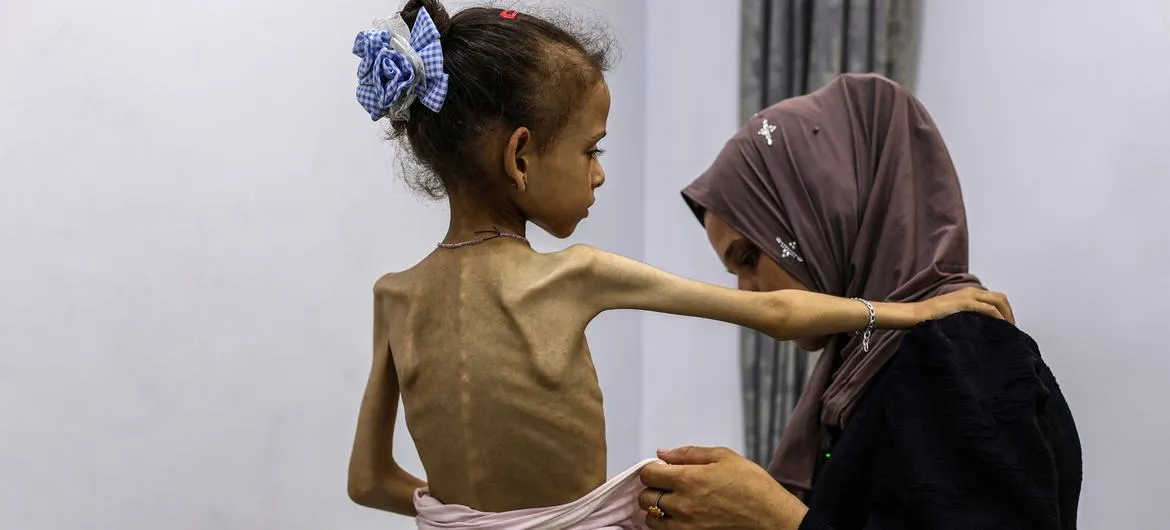Thêm 6 người Palestine chết đói trong 24 giờ qua- Ảnh 1.