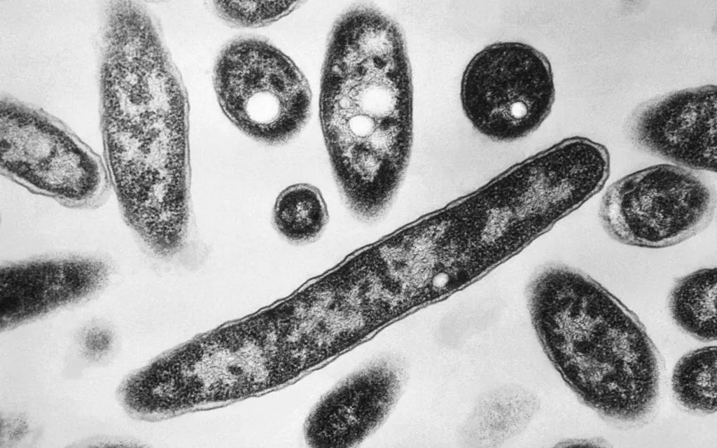 Ảnh chụp kính hiển vi năm 1978 cho thấy vi khuẩn Legionella pneumophila gây bệnh Legionnaire (Ảnh: CDC/AP)