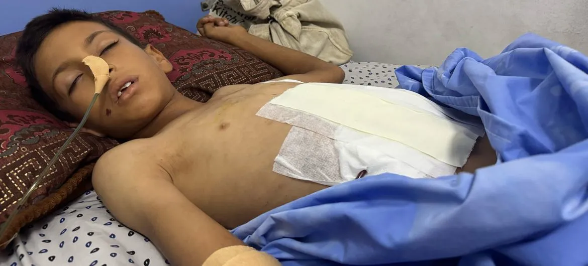 Liên hợp quốc: Khủng hoảng suy dinh dưỡng ở trẻ em Gaza chạm mức kỷ lục- Ảnh 2.