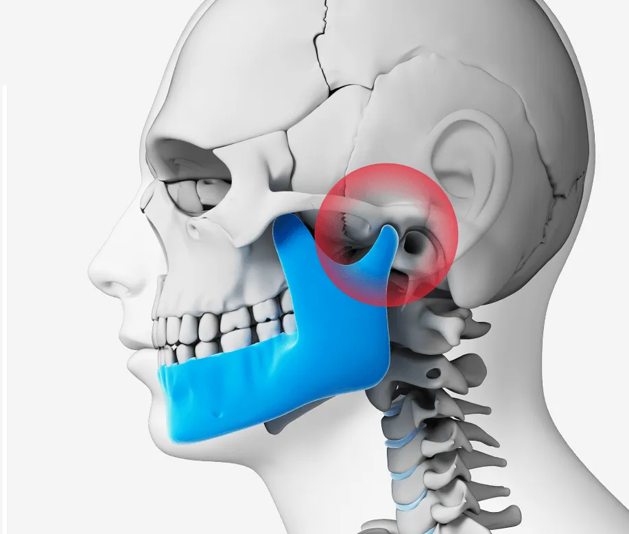 Niềng răng có phải chỉ giải quyết vấn đề thẩm mỹ?- Ảnh 3.