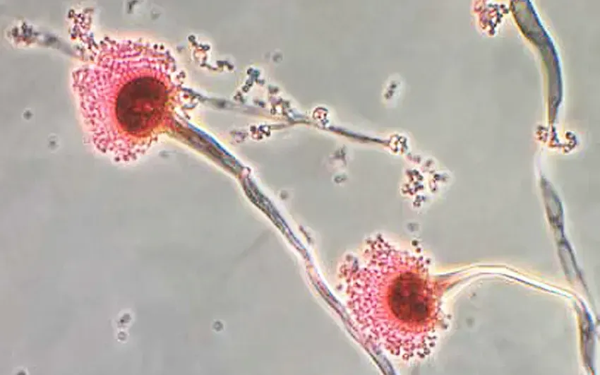Loài vi nấm Aspergillus Fumigatus (Ảnh: Trung tâm Kiểm soát dịch bệnh Mỹ) Loài vi nấm Aspergillus Fumigatus (Ảnh: Trung tâm Kiểm soát dịch bệnh Mỹ)