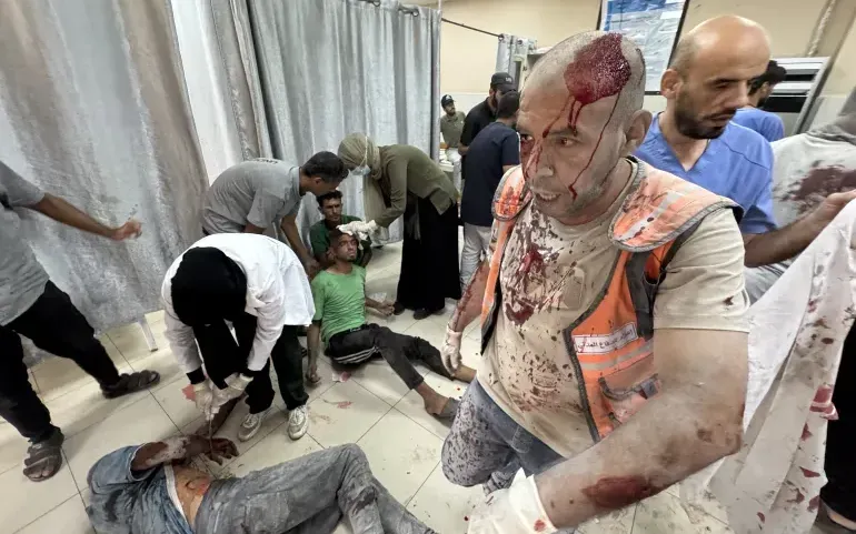 Các bệnh viện ở Gaza quá tải vì người dân Palestine bị thương do các cuộc tấn công của Israel hoặc bị ốm do điều kiện khắc nghiệt (Ảnh: Anadolu) Các bệnh viện ở Gaza quá tải vì người dân Palestine bị thương do các cuộc tấn công của Israel hoặc bị ốm do điều kiện khắc nghiệt (Ảnh: Anadolu)