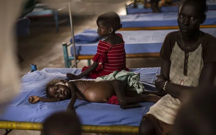 Những trẻ em bị suy dinh dưỡng nghiêm trọng ở Juba, Nam Sudan, ngày 22/3/2016 (Ảnh: Getty Images) Những trẻ em bị suy dinh dưỡng nghiêm trọng ở Juba, Nam Sudan, ngày 22/3/2016 (Ảnh: Getty Images)