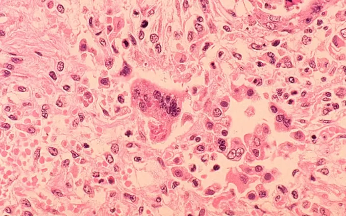 (Ảnh: CDC/Getty) (Ảnh: CDC/Getty)