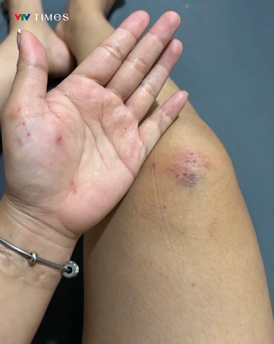 H&agrave;nh tr&igrave;nh đến lớp đầy gian nan của c&ocirc; gi&aacute;o mầm non "cắm bản" ở Điện Bi&ecirc;n - Ảnh 5.