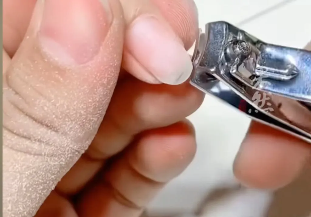 Human fingernails used in TCM to detox, heal wounds after sterilisation process in China - Ảnh 3.