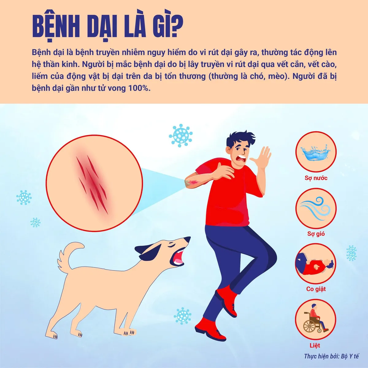 Infographic: Bệnh dại và các biện pháp phòng bệnh- Ảnh 1.
