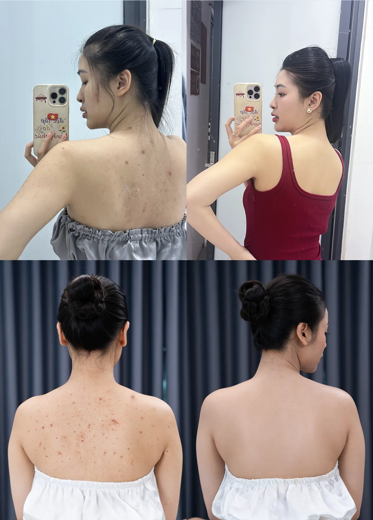 Có nên điều trị viêm nang lông tại AMI CLINIC? Góc nhìn đa chiều- Ảnh 3.