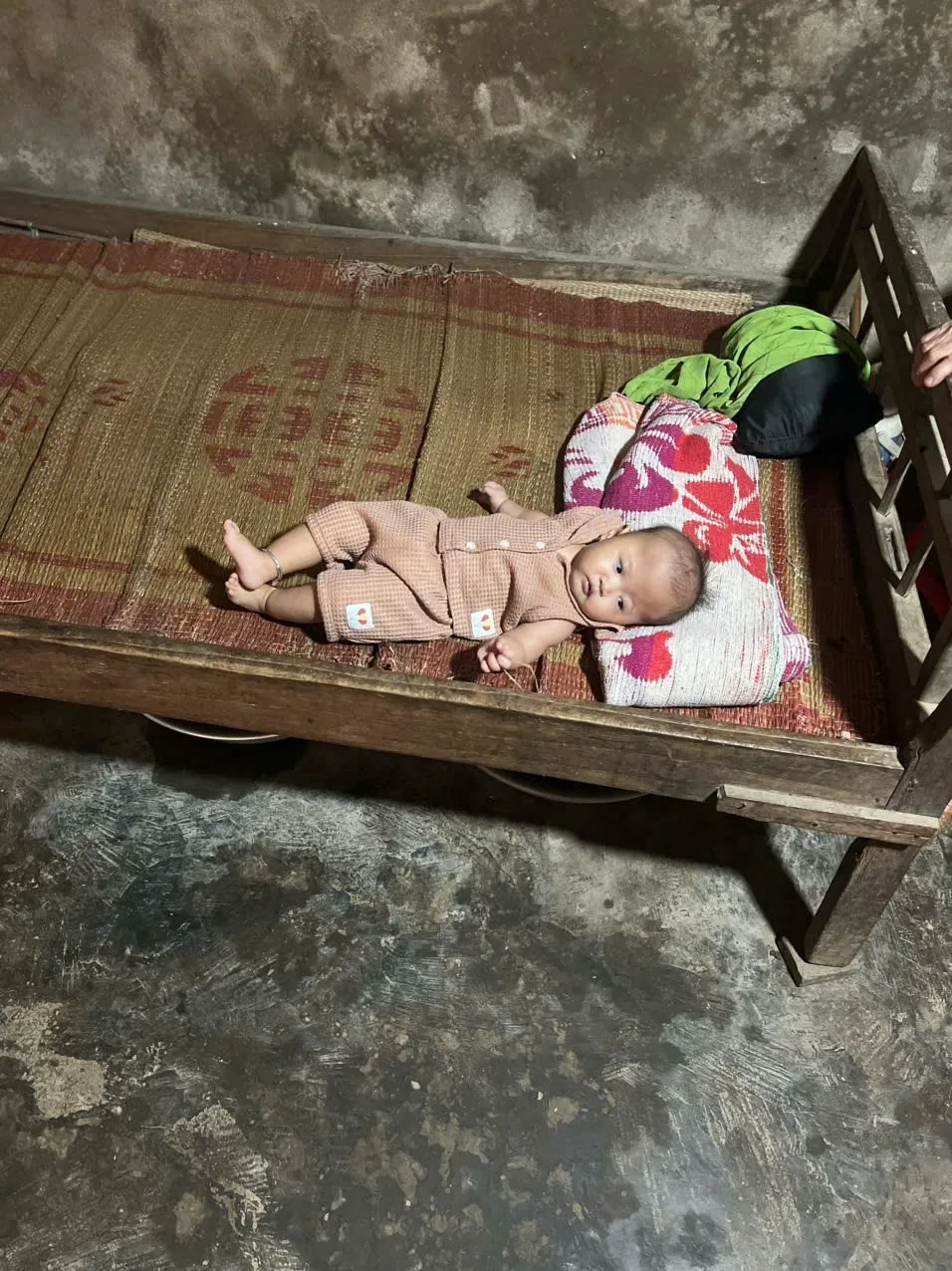 Bệnh nhi 9 tháng tuổi chênh vênh sự sống do căn bệnh tim bẩm sinh quái ác- Ảnh 1.