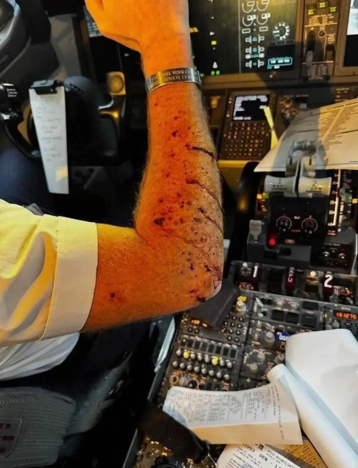 Máy bay Boeing 737 của United Airlines va trúng vật thể lạ trên không, phi công bị thương - Ảnh 2.