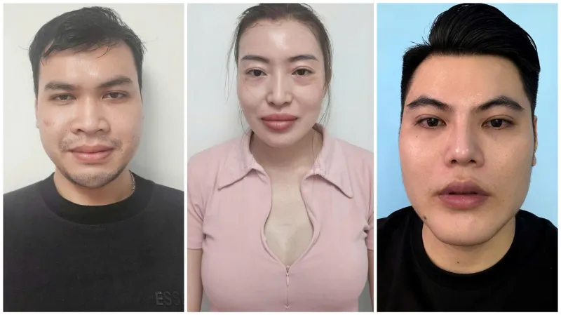 Giả danh bác sĩ khám chữa bệnh lừa đảo hơn 17 tỷ đồng, tuyển dụng cả nhân viên thú y chữa bệnh cho người - Ảnh 1.