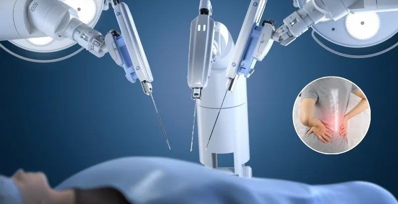 Trung Quốc phát triển công nghệ nội soi cột sống đột phá - Ảnh 1.