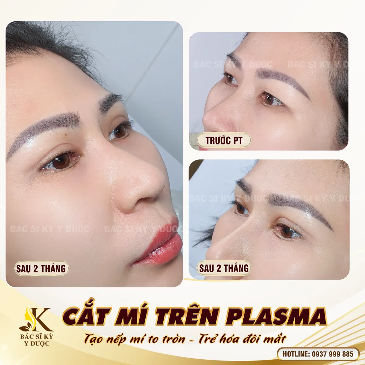 B&aacute;c sĩ Kỳ Y Dược cảnh b&aacute;o: Thẩm mỹ phải đ&uacute;ng nơi, đ&uacute;ng c&aacute;ch - Ảnh 4.