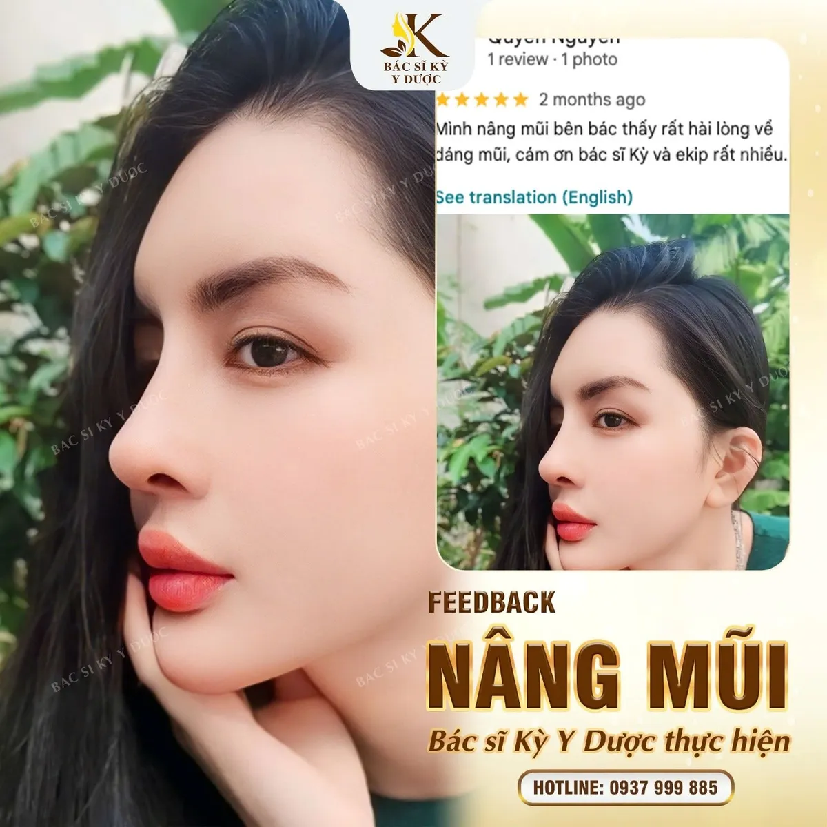 B&aacute;c sĩ Kỳ Y Dược cảnh b&aacute;o: Thẩm mỹ phải đ&uacute;ng nơi, đ&uacute;ng c&aacute;ch - Ảnh 3.