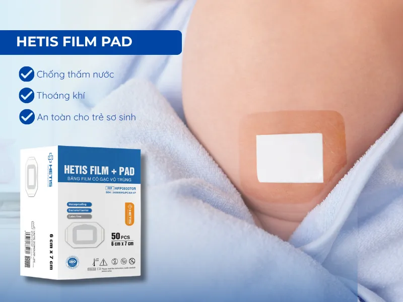 Gạc v&ocirc; tr&ugrave;ng chống thấm nước Hetis: Giải ph&aacute;p bảo vệ rốn b&eacute; những ng&agrave;y đầu đời- Ảnh 4.