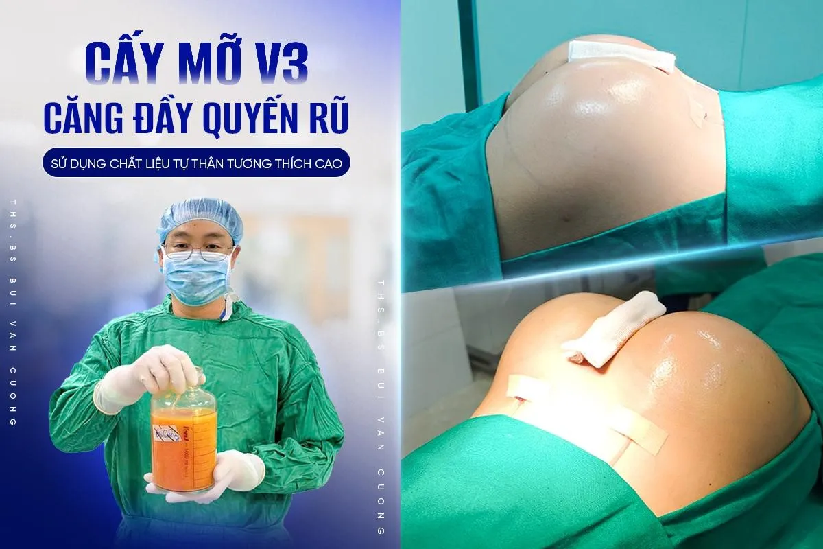 Ths.BS Bùi Văn Cường - Đón đầu xu hướng tạo hình body toàn diện - Ảnh 3.