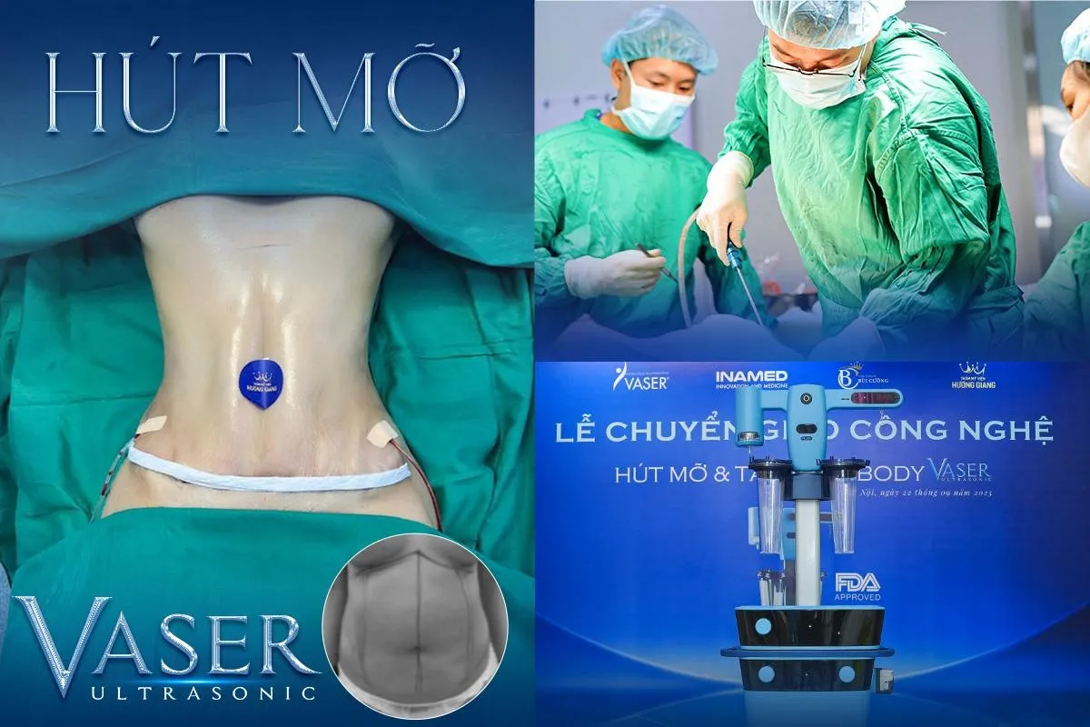 Ths.BS Bùi Văn Cường - Đón đầu xu hướng tạo hình body toàn diện - Ảnh 2.