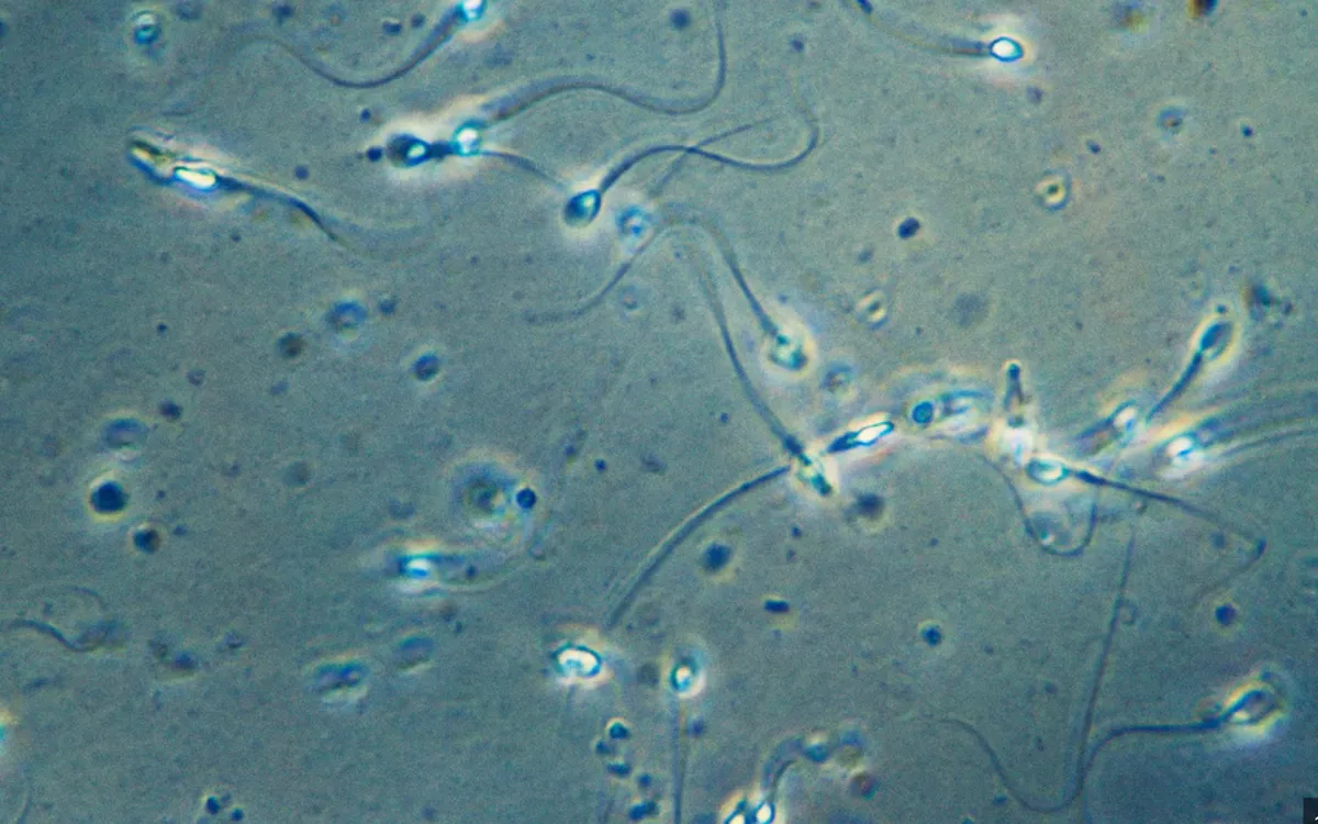 Hình ảnh tinh trùng dưới kính hiển vi (Ảnh minh họa: Getty Images)