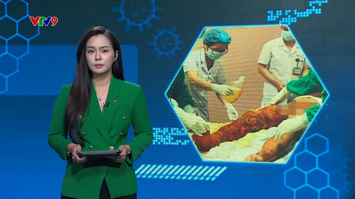 Alo Doctor (13/11/2025): Bỏng nặng do tự thí nghiệm đốt cồn tại nhà