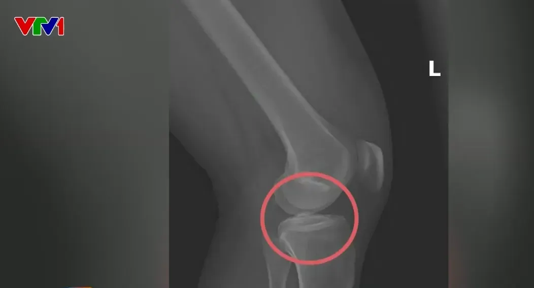 Nóng trên mạng tuần qua (10-16/11) - Ảnh 4.