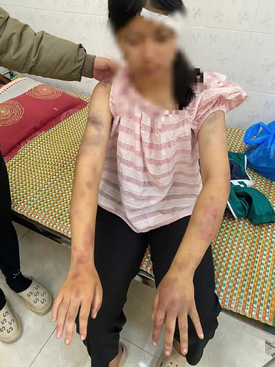 Th&aacute;i Nguy&ecirc;n: B&eacute; g&aacute;i 13 tuổi bị &ocirc;ng b&agrave; bạo h&agrave;nh d&atilde; man do bị nghi ăn trộm tiền  - Ảnh 1.