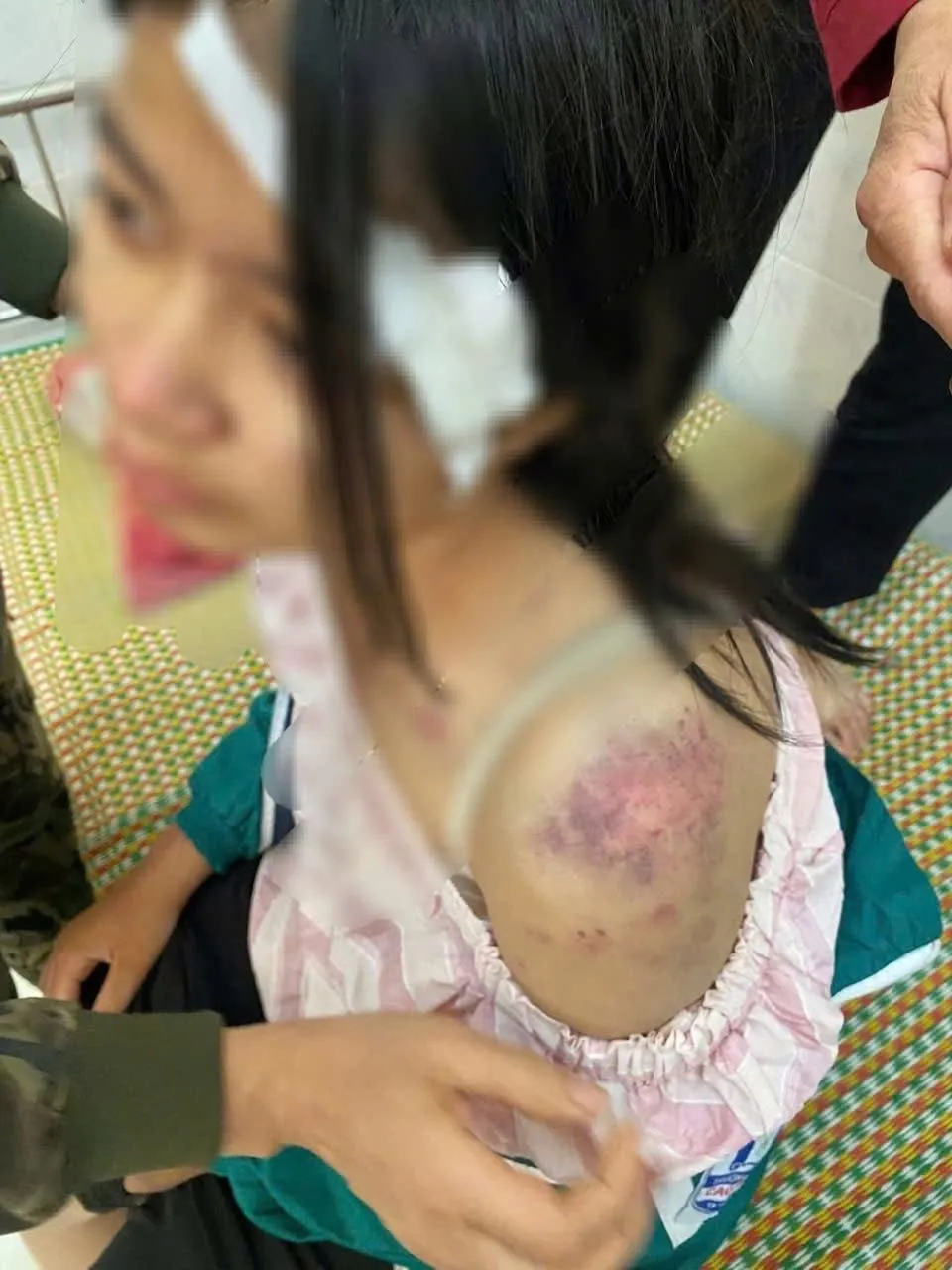 Th&aacute;i Nguy&ecirc;n: B&eacute; g&aacute;i 13 tuổi bị &ocirc;ng b&agrave; bạo h&agrave;nh d&atilde; man do bị nghi ăn trộm tiền  - Ảnh 2.