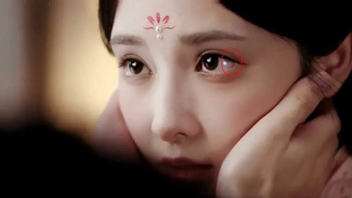 Bành Tiểu Nhiễm khóc trượt kính áp tròng vẫn tiếp tục diễn - Ảnh 3.