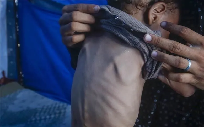 (Ảnh minh họa: Anadolu)