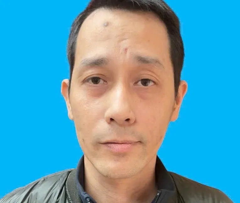 Em chồng dùng dao đâm chị dâu trọng thương  - Ảnh 1.