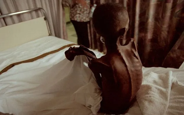 Hàng triệu người mắc HIV/AIDS có thể chết do phương Tây cắt giảm viện trợ (Ảnh minh họa: Vanessa Vick)