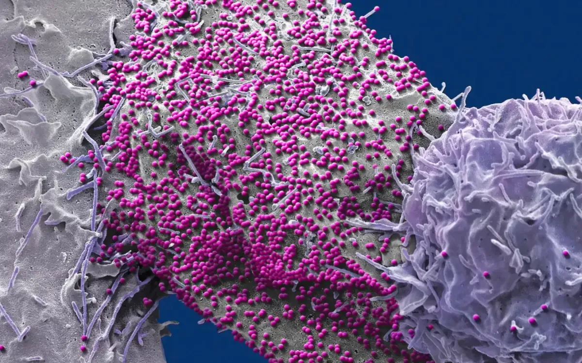 Một tế bào của người bị nhiễm HIV (Ảnh: Science Photo Library)