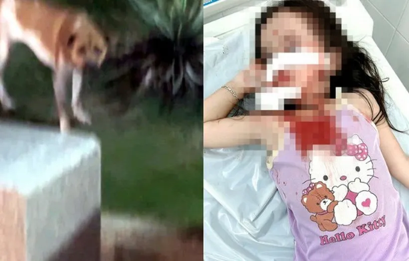 Bé gái 4 tuổi bị chó thả rông tấn công, thương tích nghiêm trọng vùng mặt - Ảnh 1.