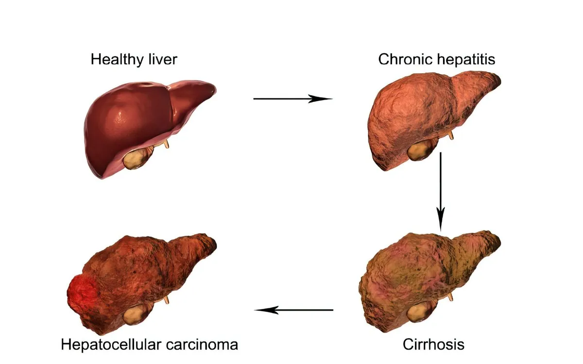 (Ảnh minh họa: BCMCH)