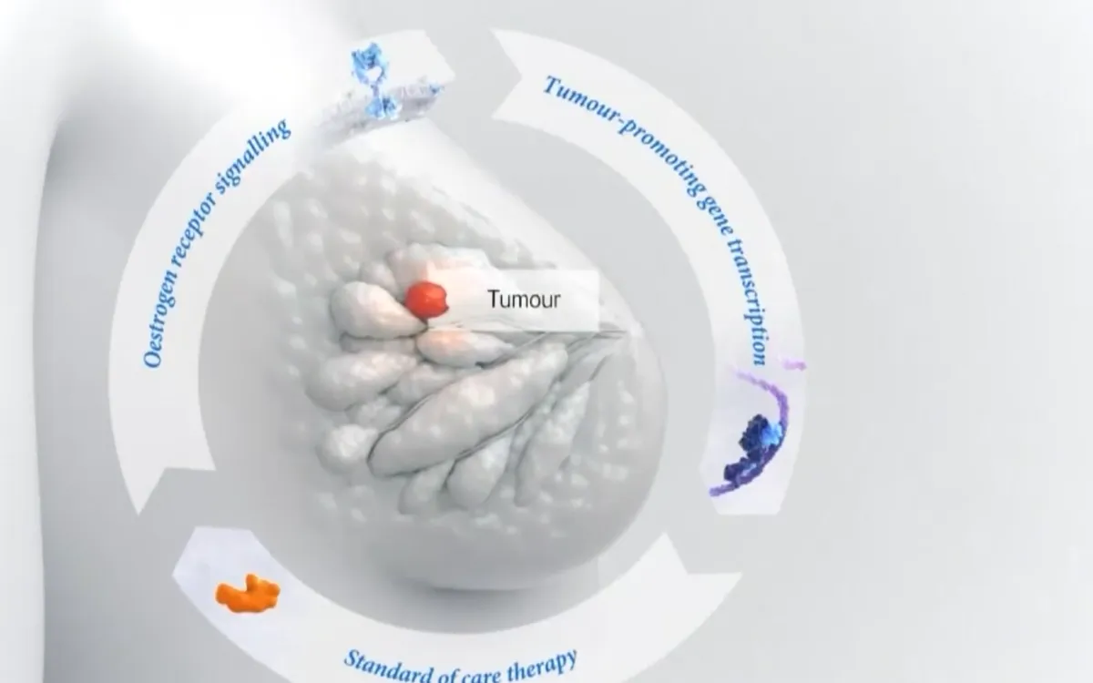 Thuốc uống thử nghiệm giúp giảm nguy cơ tái phát ung thư vú - Ảnh 1.