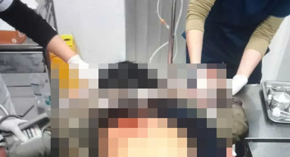 Nam thanh niên ở Khánh Hòa đâm nhân viên cây xăng trong đêm - Ảnh 2.