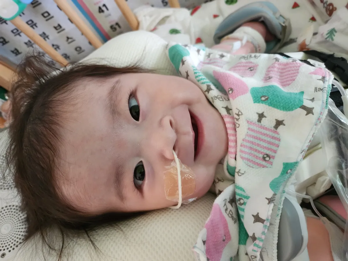 H&agrave;n Quốc điều trị th&agrave;nh c&ocirc;ng cho trẻ sơ sinh mắc chứng tim lạc chỗ - Ảnh 1.