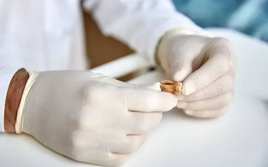 Một chiếc răng được sử dụng để phân tích ADN cổ trong nghiên cứu về quân đội của Napoleon (Ảnh: European Commission)