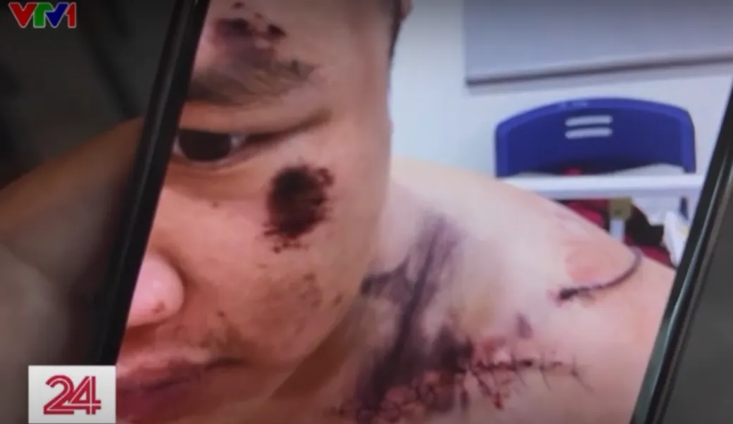 &ldquo;Gậy Hạ Long&rdquo; v&agrave; nỗi &aacute;m ảnh của những đứa trẻ tại Trung t&acirc;m c&ocirc;ng t&aacute;c x&atilde; hội Hải H&agrave; - Ảnh 6.