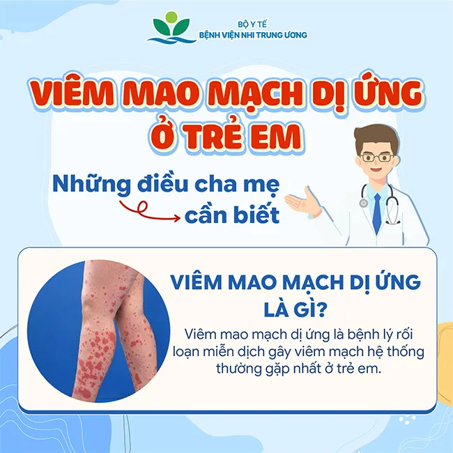 Infographic: Viêm mao mạch dị ứng ở trẻ em - Những điều cha mẹ cần biết- Ảnh 1. Infographic: Viêm mao mạch dị ứng ở trẻ em - Những điều cha mẹ cần biết- Ảnh 1.