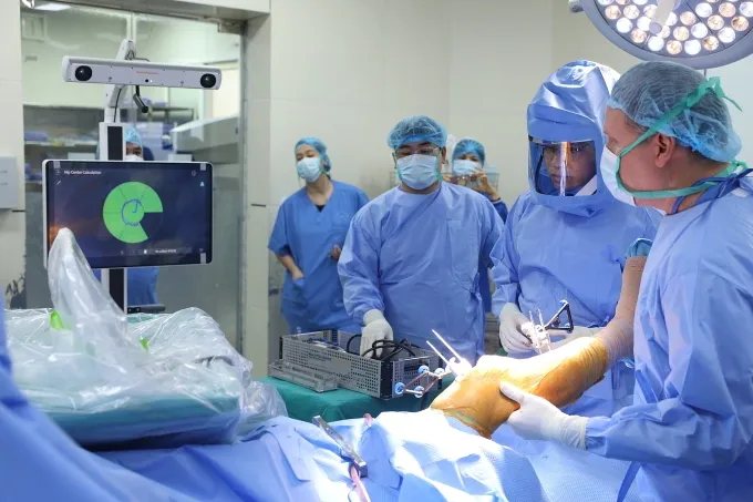 Lần đầu tại Việt Nam phẫu thuật thay khớp gối to&agrave;n phần bằng robot cầm tay- Ảnh 1.