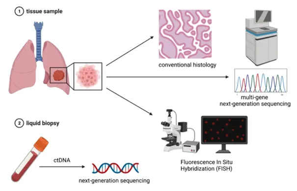 48 giờ truy tìm ADN đột biến, mở hướng điều trị đích cho bệnh nhân ung thư- Ảnh 1. 48 giờ truy tìm ADN đột biến, mở hướng điều trị đích cho bệnh nhân ung thư- Ảnh 1.