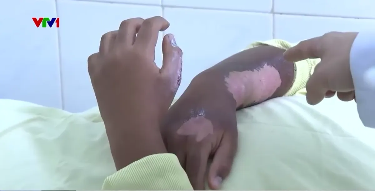 Hiểm họa ph&aacute;o lậu cận Tết - Ảnh 3.