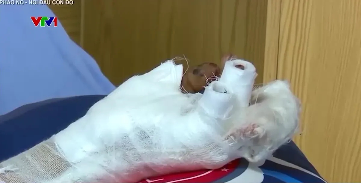 Hiểm họa ph&aacute;o lậu cận Tết - Ảnh 5.