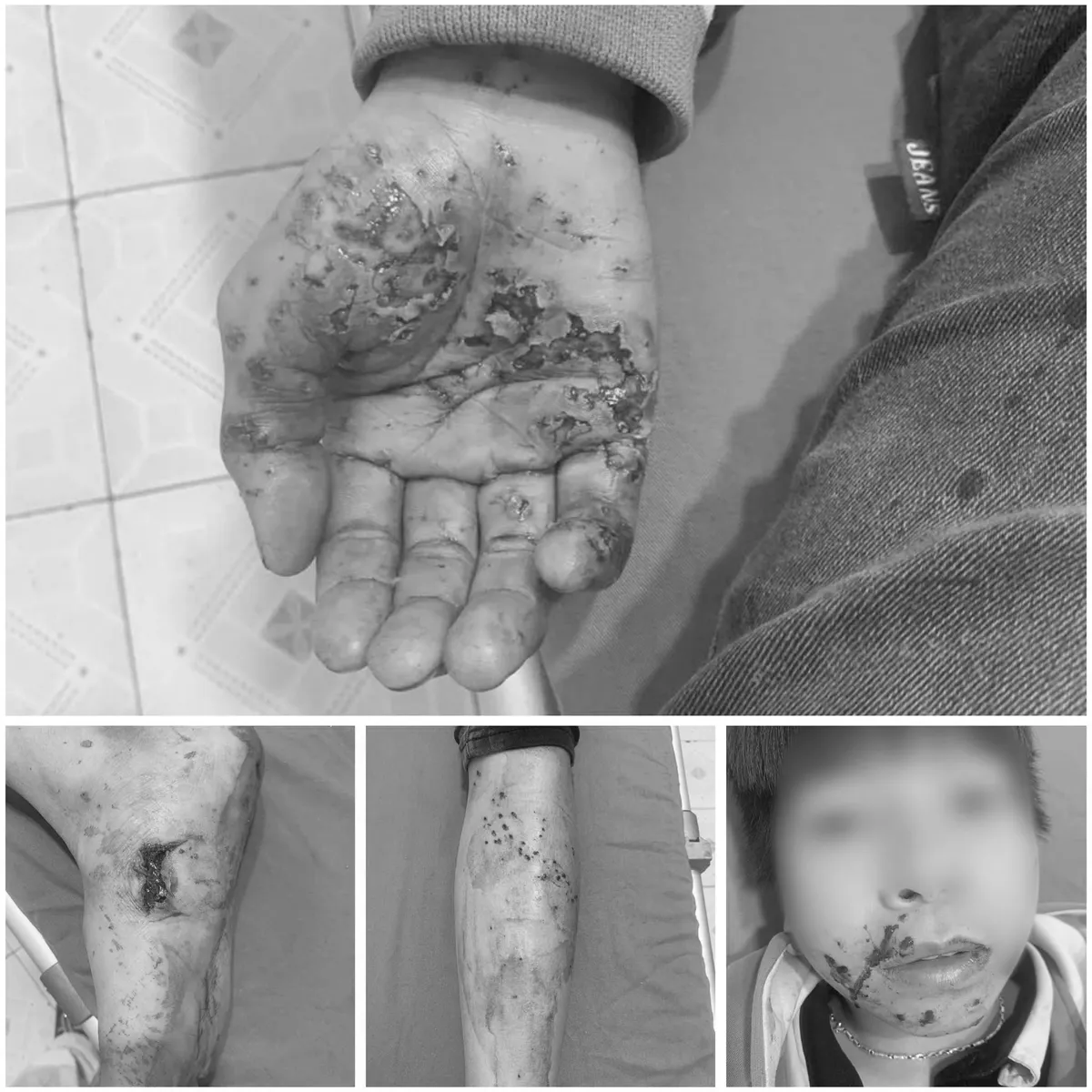 Cảnh b&aacute;o tai nạn nguy hiểm khi vừa sạc vừa sử dụng điện thoại- Ảnh 1.