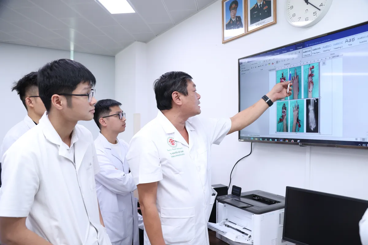 Nguy cơ mất to&agrave;n bộ b&agrave;n tay tr&aacute;i v&igrave; ph&aacute;o nổ- Ảnh 2.