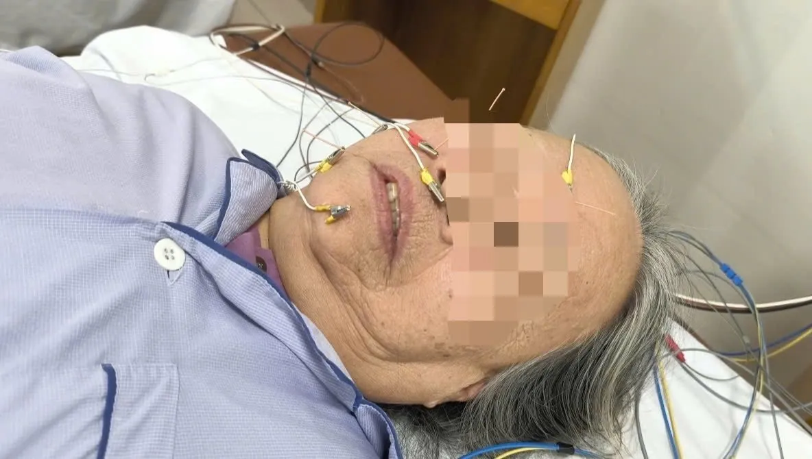 Trời r&eacute;t đột ngột, gia tăng ca liệt d&acirc;y thần kinh số VII ngoại bi&ecirc;n- Ảnh 2.