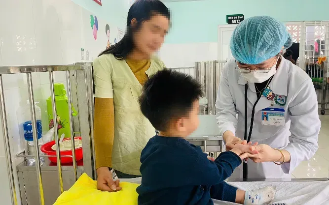 B&eacute; 3 tuổi mắc tay ch&acirc;n miệng nặng, xuất hiện biến chứng thần kinh- Ảnh 1.