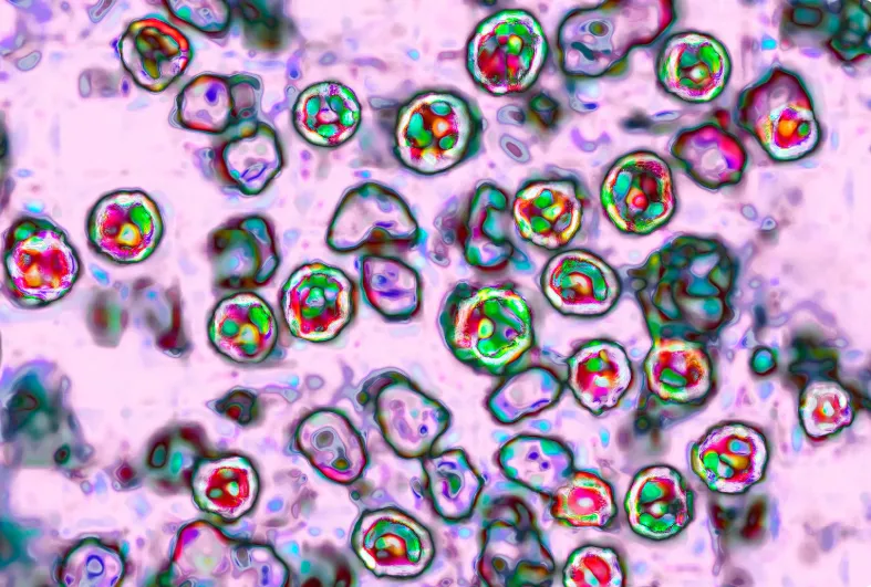 Gần 800 trường hợp mắc sởi trong đợt b&ugrave;ng ph&aacute;t dịch kỷ lục ở bang South Carolina (Mỹ) - Ảnh 1.
