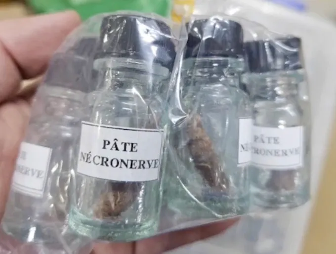 Thạch t&iacute;n bị loại khỏi nha khoa, b&aacute;c sĩ cảnh b&aacute;o chi&ecirc;u tr&ograve; chữa tủy &ldquo;si&ecirc;u tốc&rdquo;- Ảnh 1.